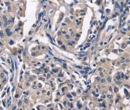 PEBP1 Polyclonal Antibody - 2