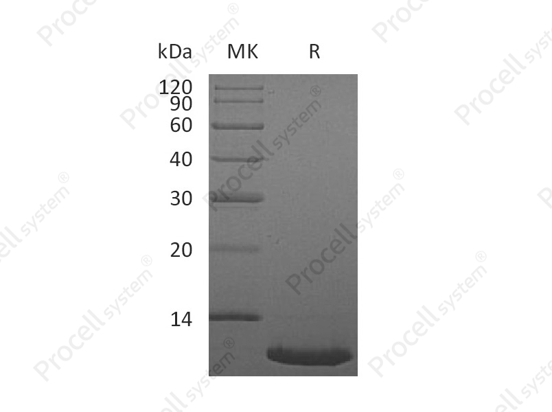 SDF-1&alpha;/SDF-1&beta;/CXCL12 (22-89), Human, Recombinant