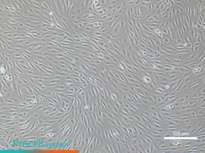 Human Umbilical Vein Endothelial Cell Complete Medium - small - 4