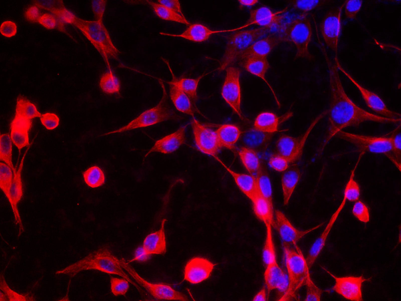 beta Tubulin Monoclonal Antibody - small - 4