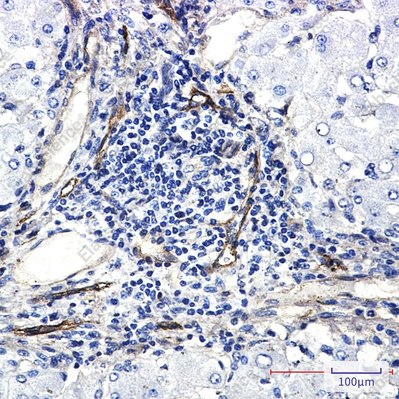 Recombinant ORAI3 Monoclonal Antibody - 2