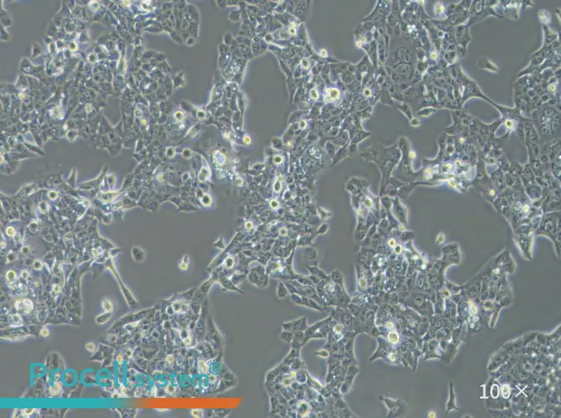 NCI-H441 Cell Complete Medium - 2
