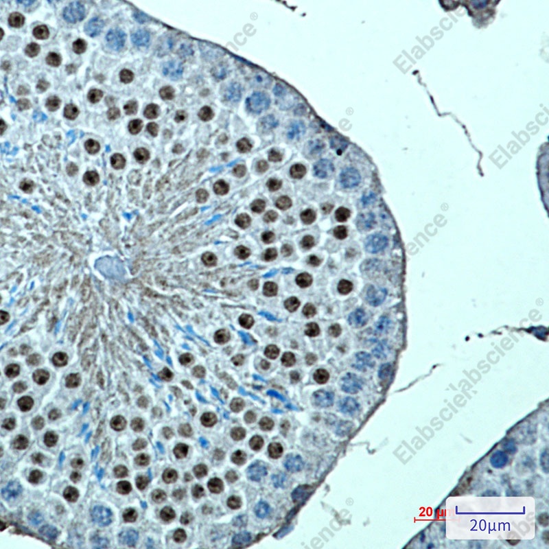 Recombinant KMT4 Monoclonal Antibody - 1