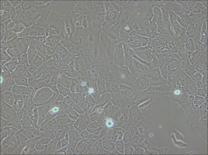 SCC-9 [SCC 9; SCC9] Cell Complete Medium - small - 4