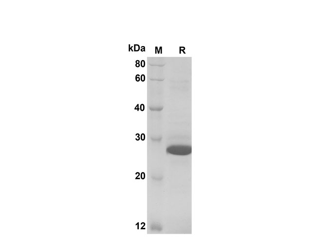 Recombinant Mouse CD30 Protein(Fc Tag)-产品推荐-1