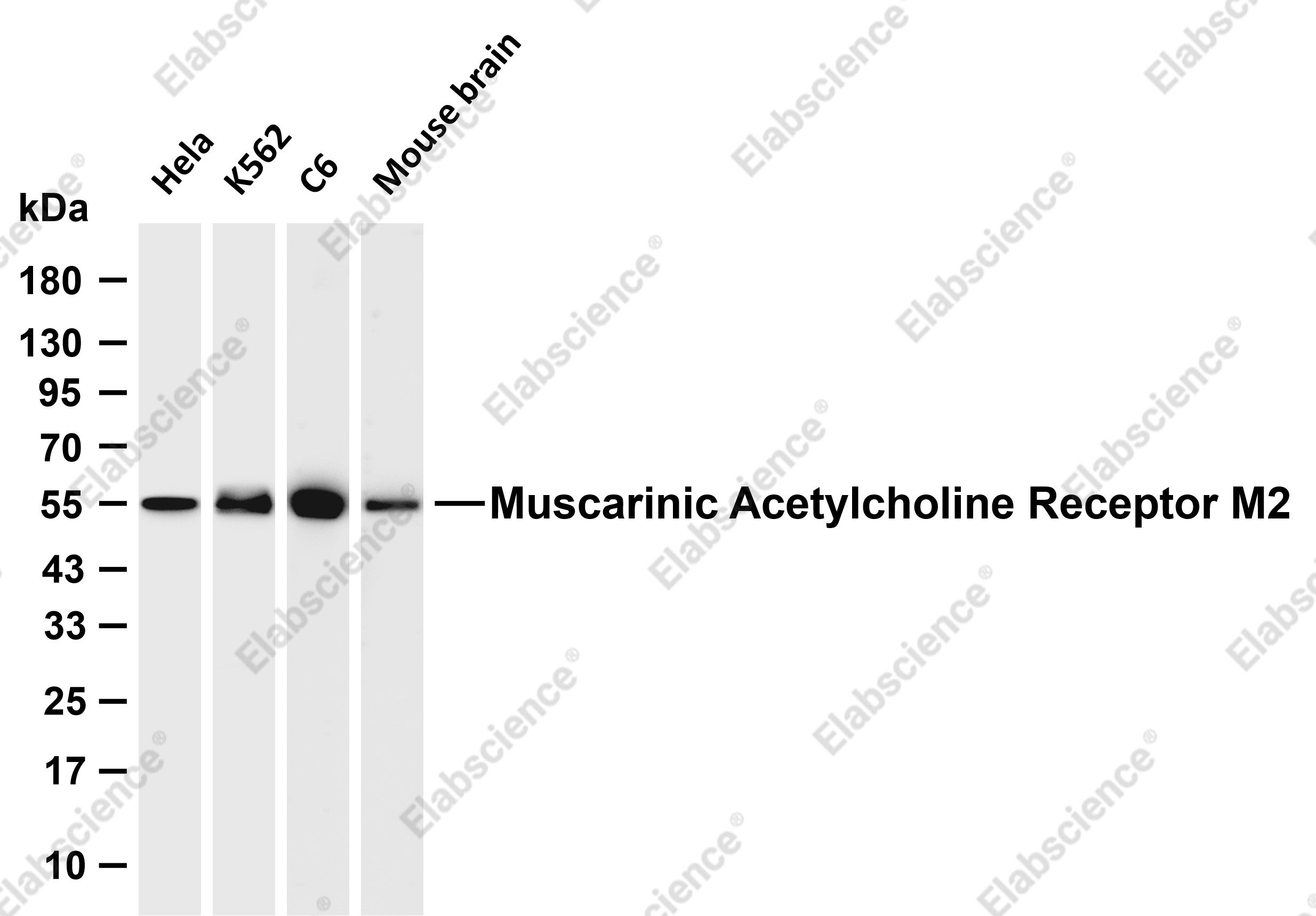 Recombinant Muscarinic Acetylcholine Receptor 2/CM2 Monoclonal Antibody - 1