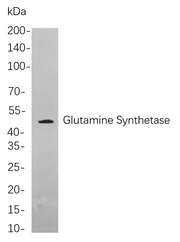 Recombinant Glutamine Synthetase Monoclonal Antibody-searchlist-1