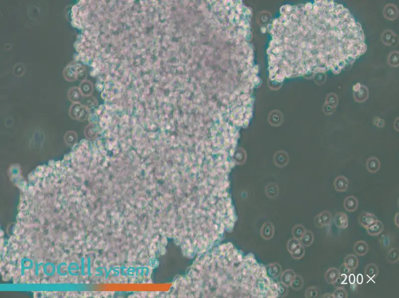 NCI-H1417 Cell Complete Medium - 5