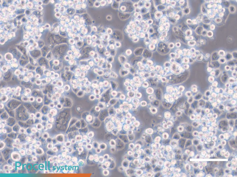 MDA-kb2 - 6