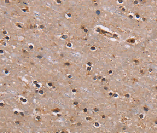 GNL3 Polyclonal Antibody - 2