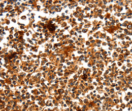 MYOZ1 Polyclonal Antibody - 2