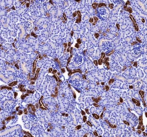 Recombinant Calbindin Monoclonal Antibody - small - 3
