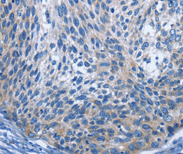 IL2RB Polyclonal Antibody - 3