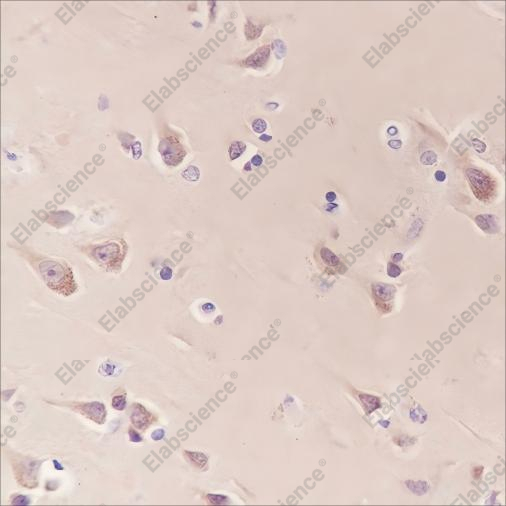 Recombinant MAP1LC3A Monoclonal Antibody - 2