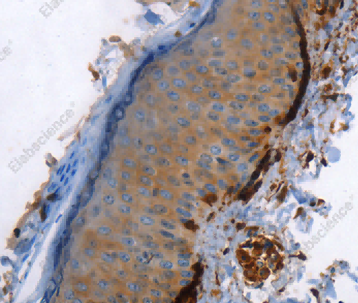 Caldesmon Polyclonal Antibody - 3
