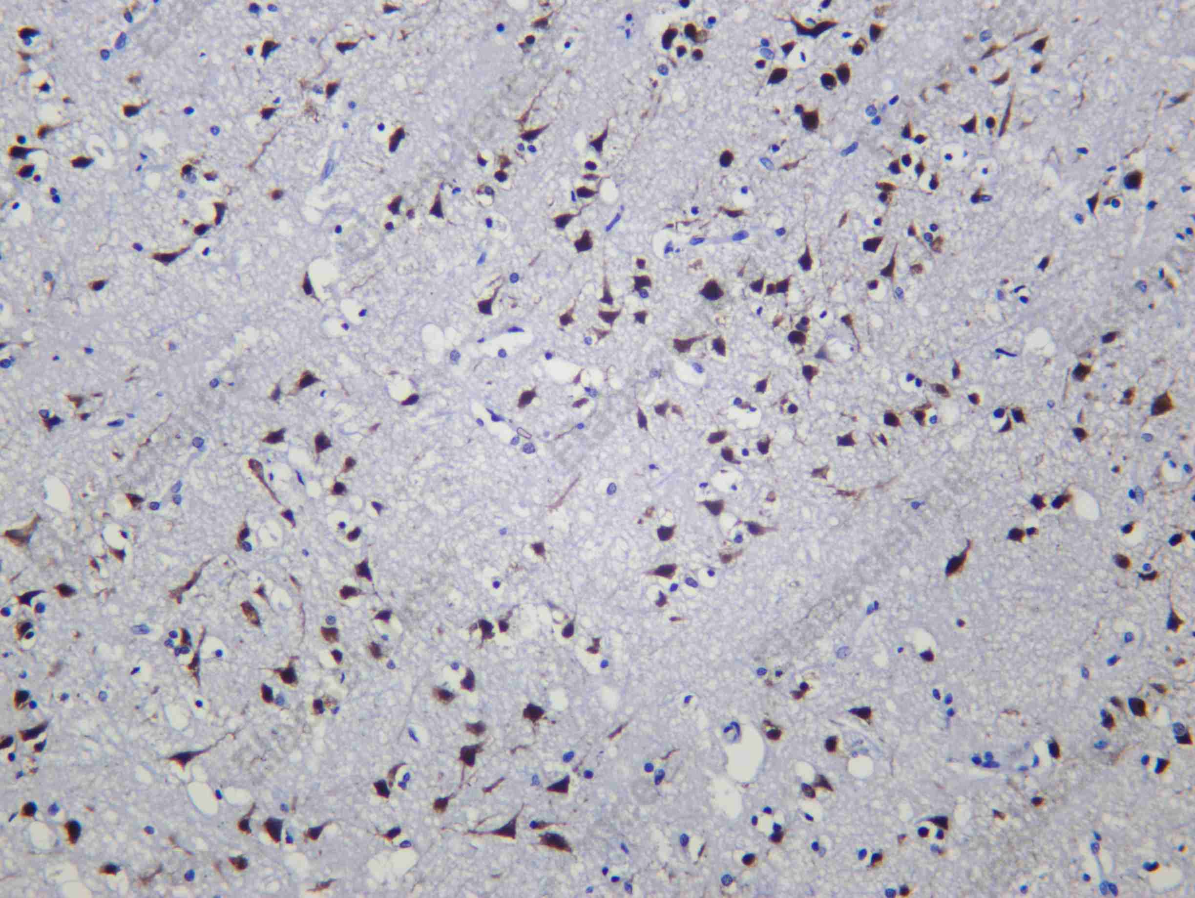 Recombinant NOVA1 Monoclonal Antibody - 1