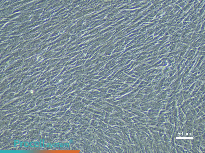 Rabbit Pulmonary Great Artery Smooth Muscle Cell Complete Medium - 6
