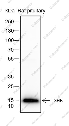 Recombinant TSHB Monoclonal Antibody - 1
