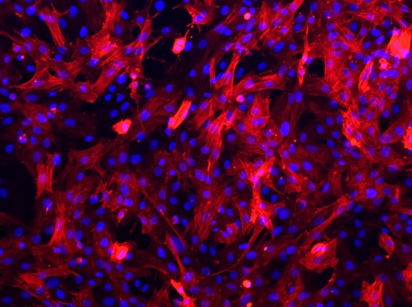 Rat Aortic Smooth Muscle Cell Complete MediumRat Aortic Smooth Muscle Cell Complete Medium - 2