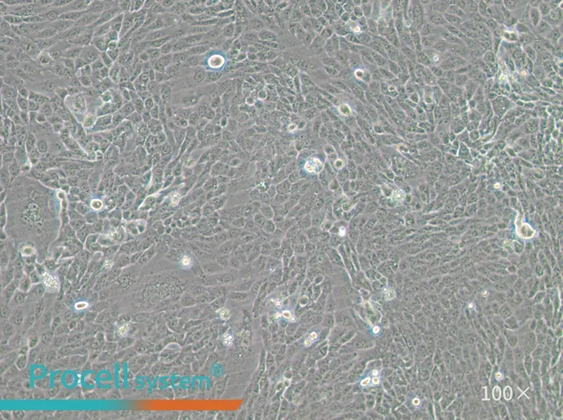 CFPAC-1 Cell Complete Medium - 1