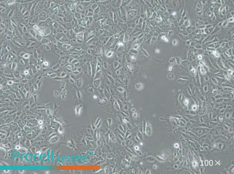 NCI-H1666 Cell Complete Medium - 1