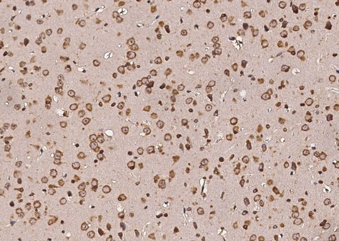 Recombinant P4HB Monoclonal Antibody - small - 3