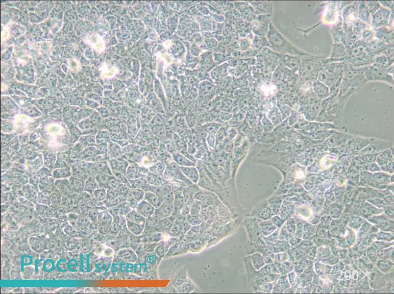 NCI-H2228 [H2228; H-2228] Cell Complete Medium - small - 4