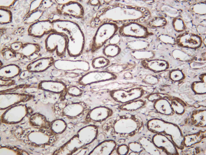 Recombinant METTL16 Monoclonal Antibody - 1