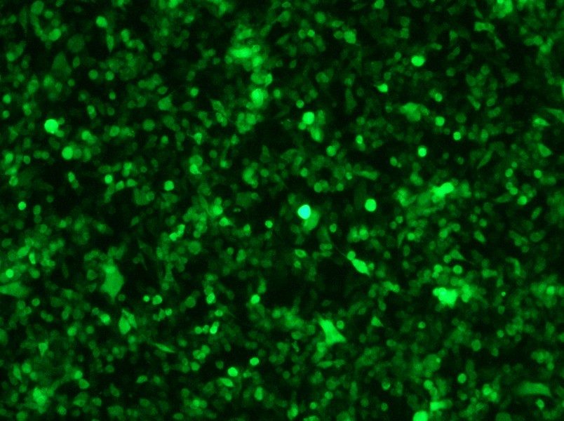 RM-1-GFP Cell Complete Medium - small - 8