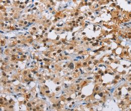 ATXN1 Polyclonal Antibody - 2