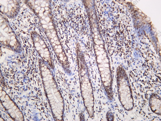 Recombinant HMG-2 Monoclonal Antibody - 1