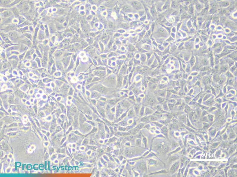 Rat Brain Microvascular Endothelial (Primary cell immortalization) Cell Complete MediumRat Brain Microvascular Endothelial (Primary cell immortalization) Cell Complete Medium - 5