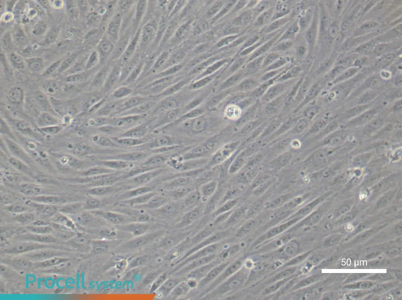 Human Choroidal Microvascular Endothelial Cell Complete Medium - 5