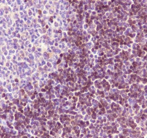 Recombinant ADK Monoclonal Antibody-searchlist-2