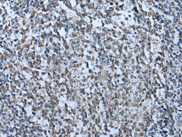 Immunohistochemistry of paraffin-embedded Human tonsil tissue  using ZNHIT3 Polyclonal Antibody at dilution of 1:95(?200)