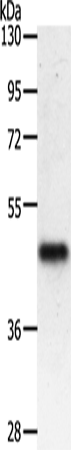 Western Blot analysis of Mouse heart tissue using PDK2 Polyclonal Antibody at dilution of 1:500