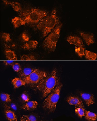 Immunofluorescence analysis of C6 cells using Enpp1 Polyclonal Antibody at dilution of 1:100. Blue: DAPI for nuclear staining.