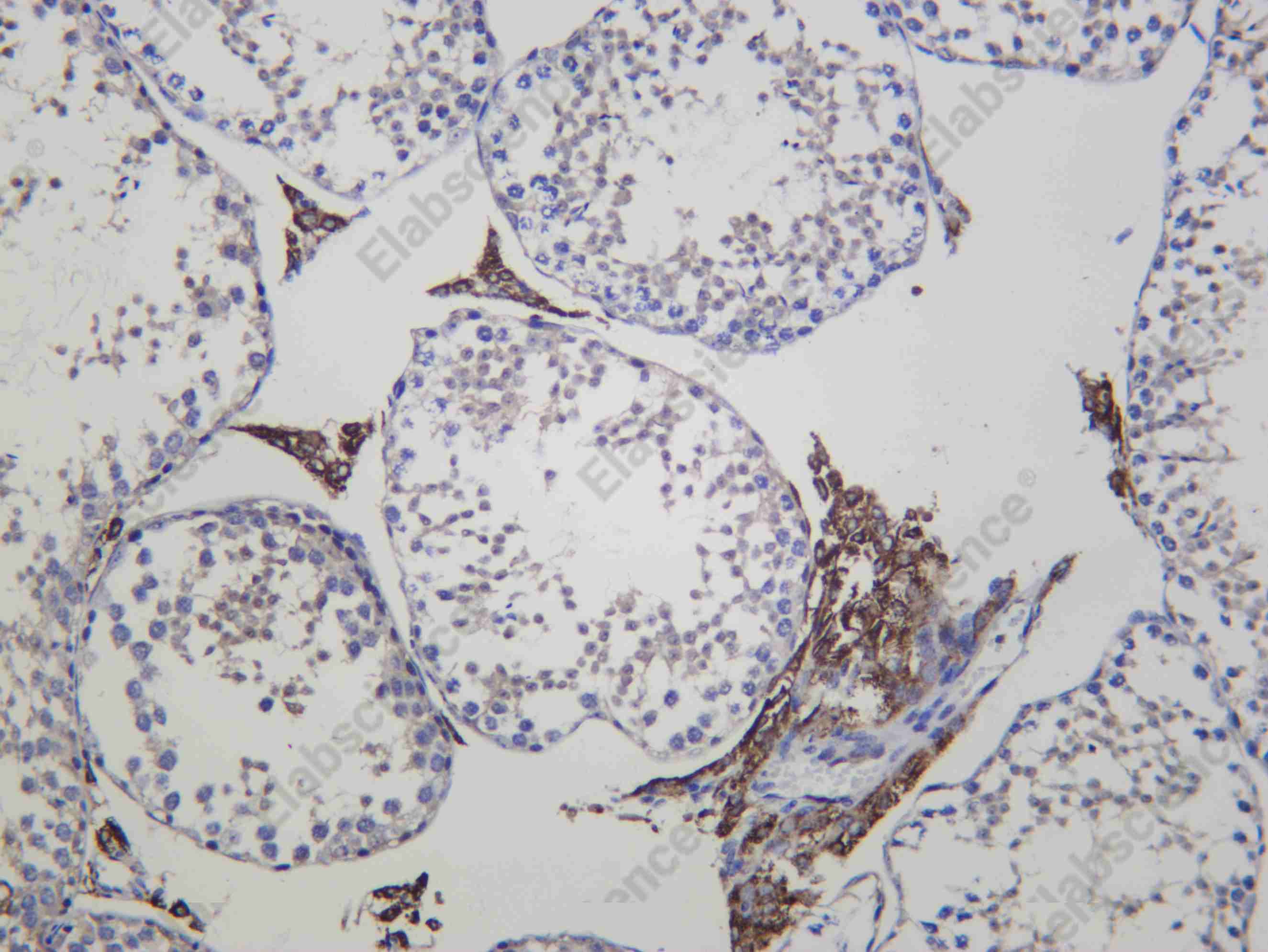 Recombinant CYP11A1 Monoclonal Antibody - 3