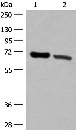 Western blot analysis of Human placenta tissue and Human fetal brain tissue lysates  using TRIM8 Polyclonal Antibody at dilution of 1:500