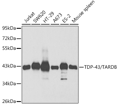 Western blot analysis of extracts of various cell lines using TDP-43/TARDB Polyclonal Antibody at 1:1000 dilution.