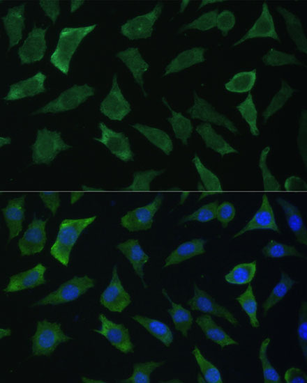 Immunofluorescence analysis of L929 cells using ECE1 Polyclonal Antibody at dilution of 1:100 (40x lens). Blue: DAPI for nuclear staining.