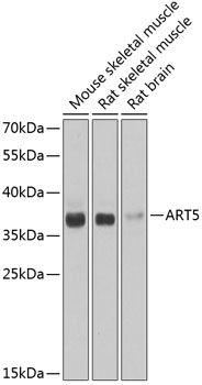 Western blot analysis of extracts of various cell lines using ART5 Polyclonal Antibody at 1:1000 dilution.