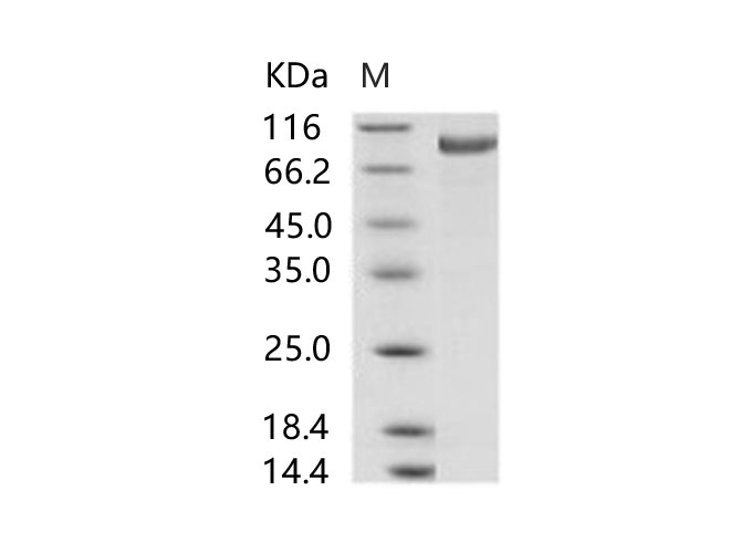 1. Immobilized Spike Protein S1 (aa 1-725) (Cat: PKSV030240) at 10 ug/ml (100 ul/well) can bind biotinylated human DPP4 (Cat: PKSH033811). The EC50 of of biotinylated DPP4 (Cat: PKSH033811) is 0.52-1. 22 ug/ml. 2. Immobilized Spike Protein S1 (aa 1-725) (Cat: PKSV030240) at 10 ug/ml (100 ul/well) can bind biotinylated Fc-DPP4 (Cat: PKSH030456). The EC50 of biotinylated Fc-DPP4 (Cat: PKSH030456) is 0.02-0.06 ug/ml.