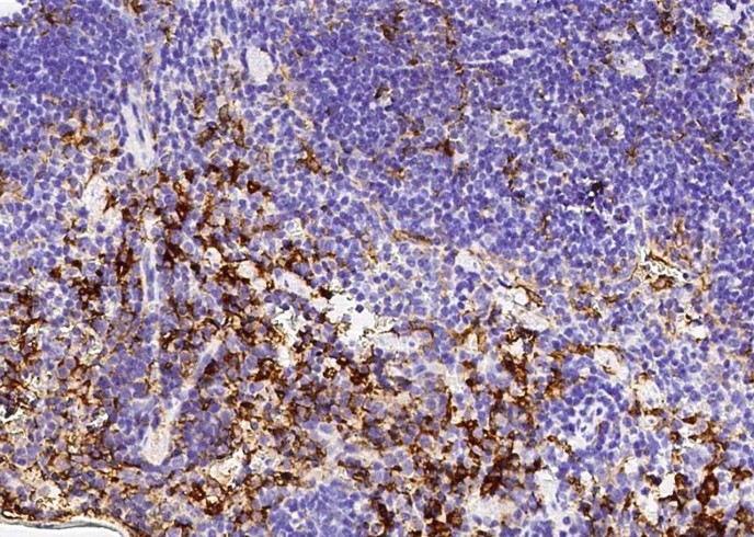 Recombinant NAALADL1 Monoclonal Antibody-searchlist-1