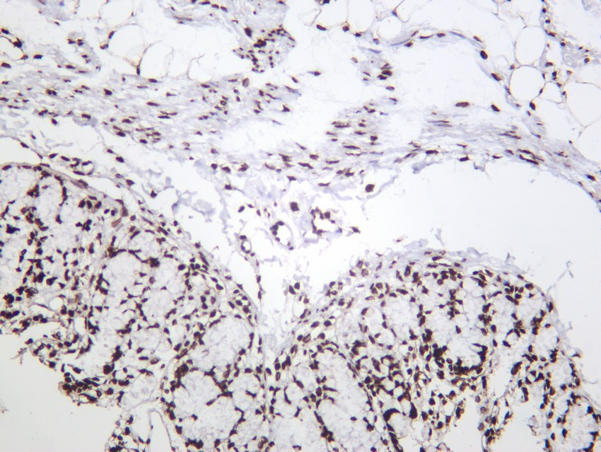 Recombinant Histone H3 Monoclonal Antibody - small - 5