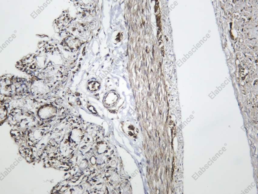 Recombinant Muscarinic Acetylcholine Receptor 2/CM2 Monoclonal Antibody - 2