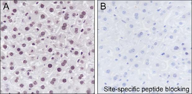 Recombinant Histone H4 (Mono Methyl Lys12) Monoclonal Antibody - small - 4