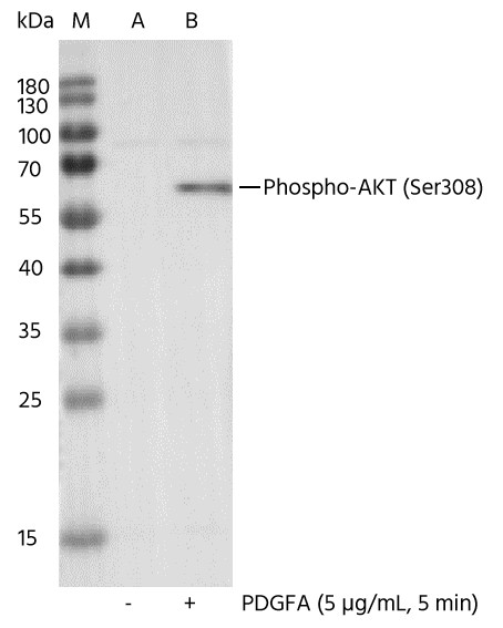 Recombinant Phospho-Akt (Thr308) Monoclonal Antibody - small - 1