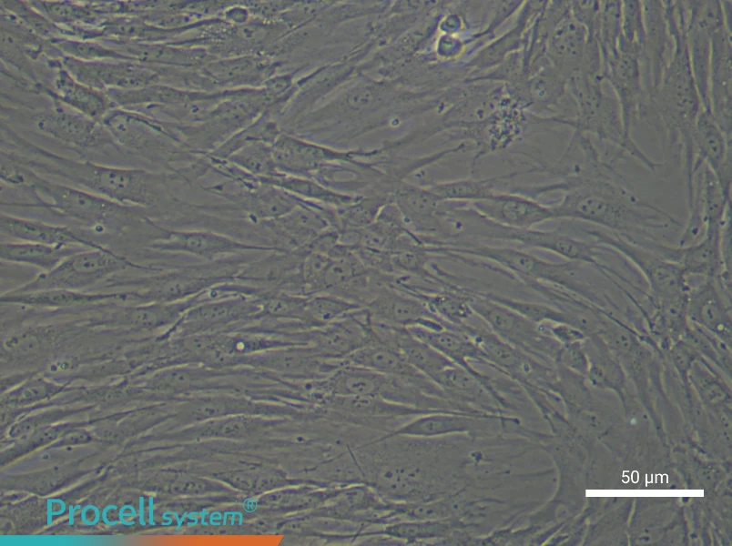Human Esophageal Cancer Fibroblast Complete Medium - 5