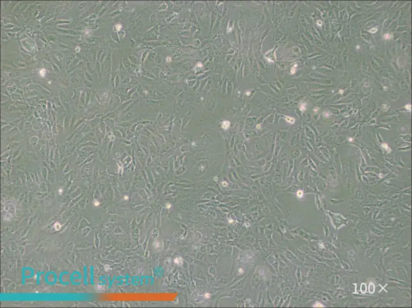 PUMC-HUVEC-T1 Cell Complete Medium - 3